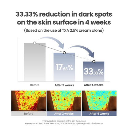 TXA Intensive Dark Spot Brightening Cream